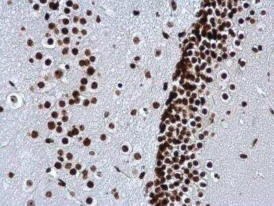 Immunohistochemistry-Paraffin: Histone H3 [Trimethyl Lys27] Antibody [NBP2-16840]